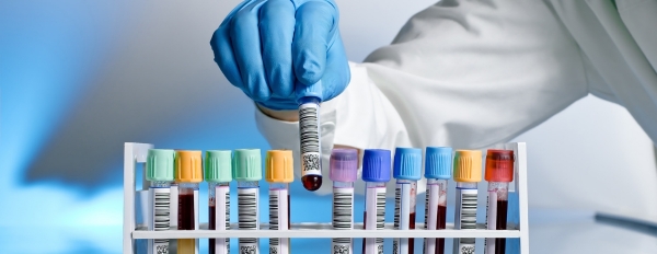 Laboratory & Health Checkup - Pride labs